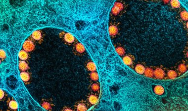 Número de mortos pela covid-19 no Brasil passa de 620 mil