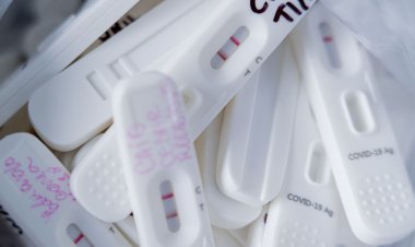 ANS aprova inclusão de teste rápido na cobertura de planos