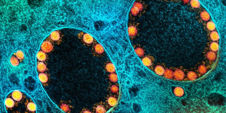 Número de mortos pela covid-19 no Brasil passa de 620 mil