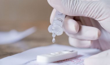 Taxa de positividade de testes de covid-19 cai para 6,8% no Rio