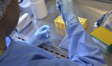 Pesquisa da UFMG desenvolve método para tratar câncer cerebral