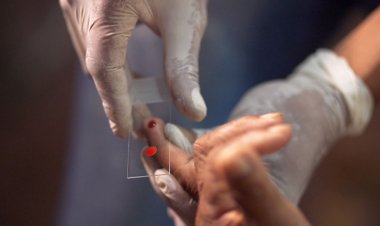 Ministério da Saúde quer zerar casos de malária no país até 2035