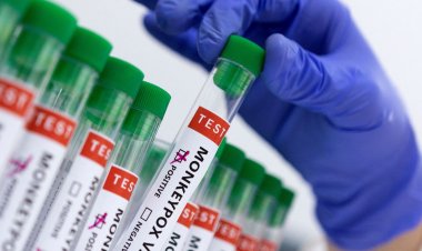 Fiocruz produz insumos para diagnóstico da varíola dos macacos