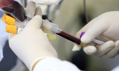 Hemorio lança campanha para incentivar doações de sangue