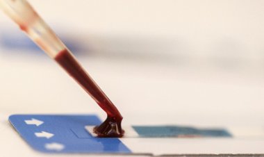 Paciente é declarado curado do HIV após receber células-tronco