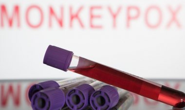 Sociedades médicas alertam sobre cuidados com a varíola dos macacos