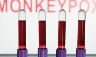 Anvisa autoriza uso emergencial de kits para varíola dos macacos