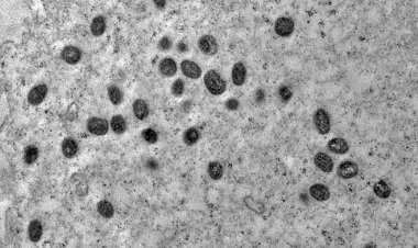 Rio confirma primeiro caso de varíola de macacos em unidade prisional