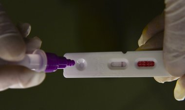 País registra 11.722 casos de covid-19 e 92 mortes em 24 horas