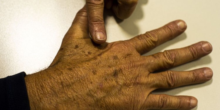 Brasil terá 704 mil novos casos de câncer por ano até 2025, diz Inca